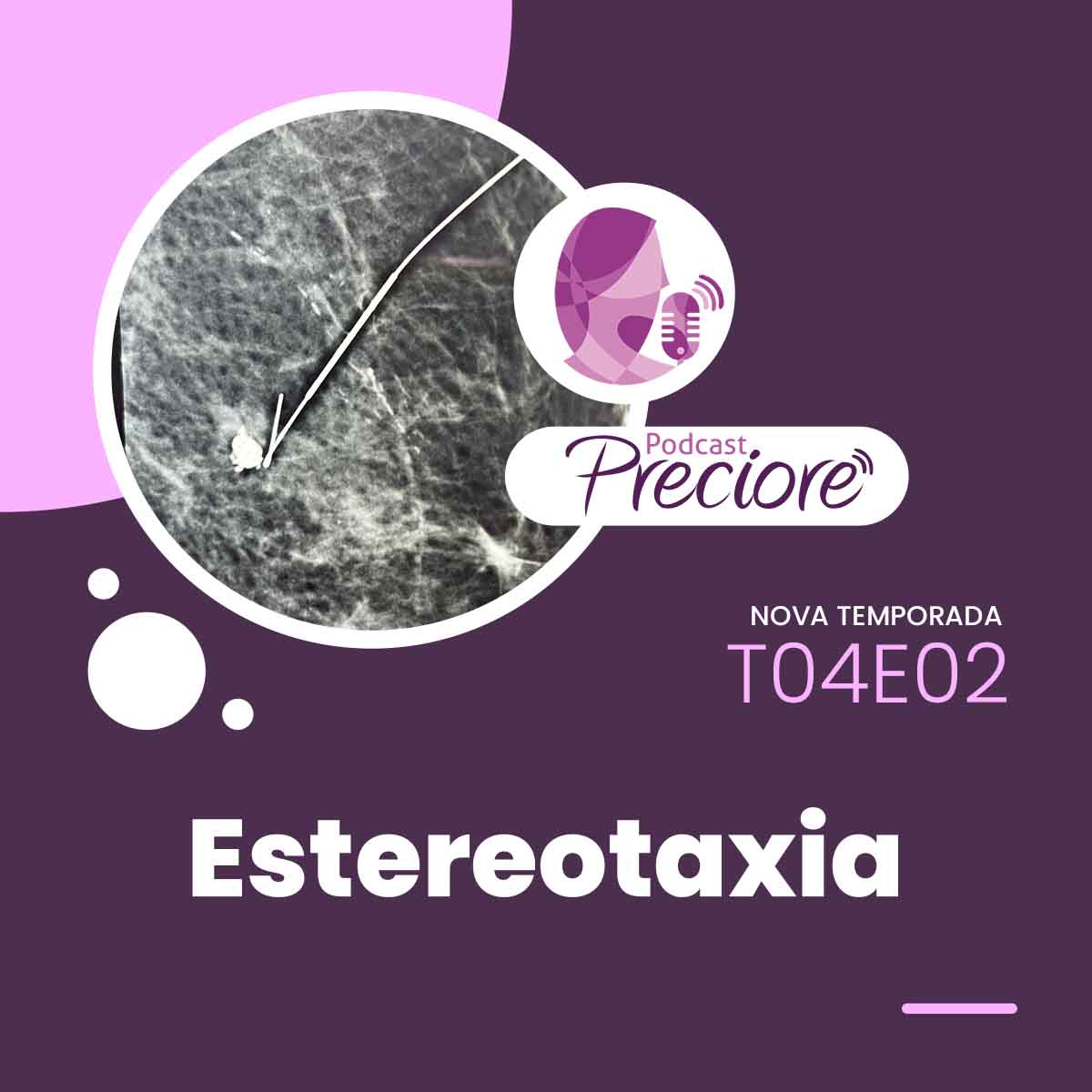 Preciore - T04E02 - Estereotaxia