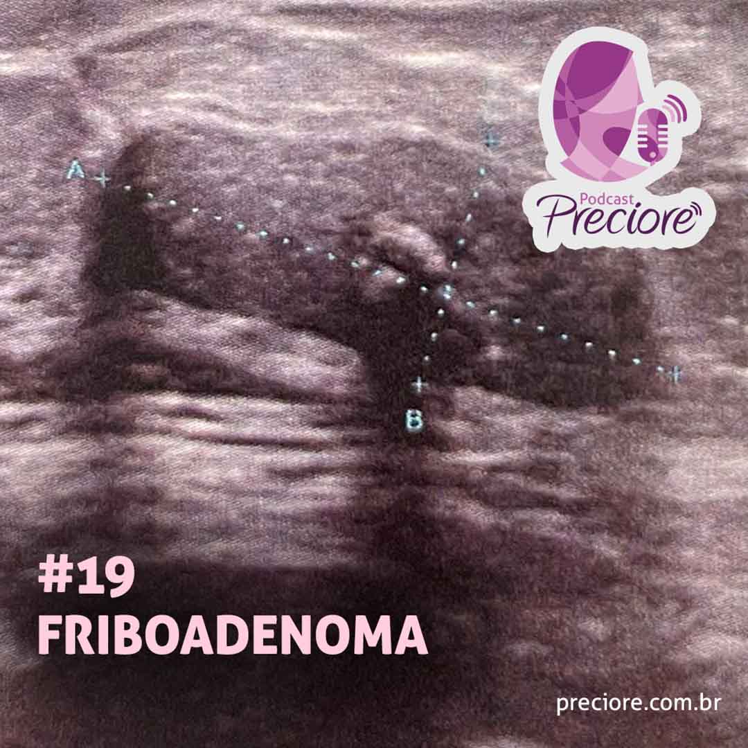 Podcast Preciore - T03E04 - Friboadenoma