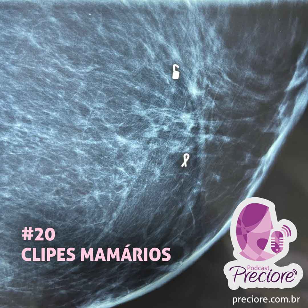 Podcast Preciore - T03E05 - Clipes Mamários
