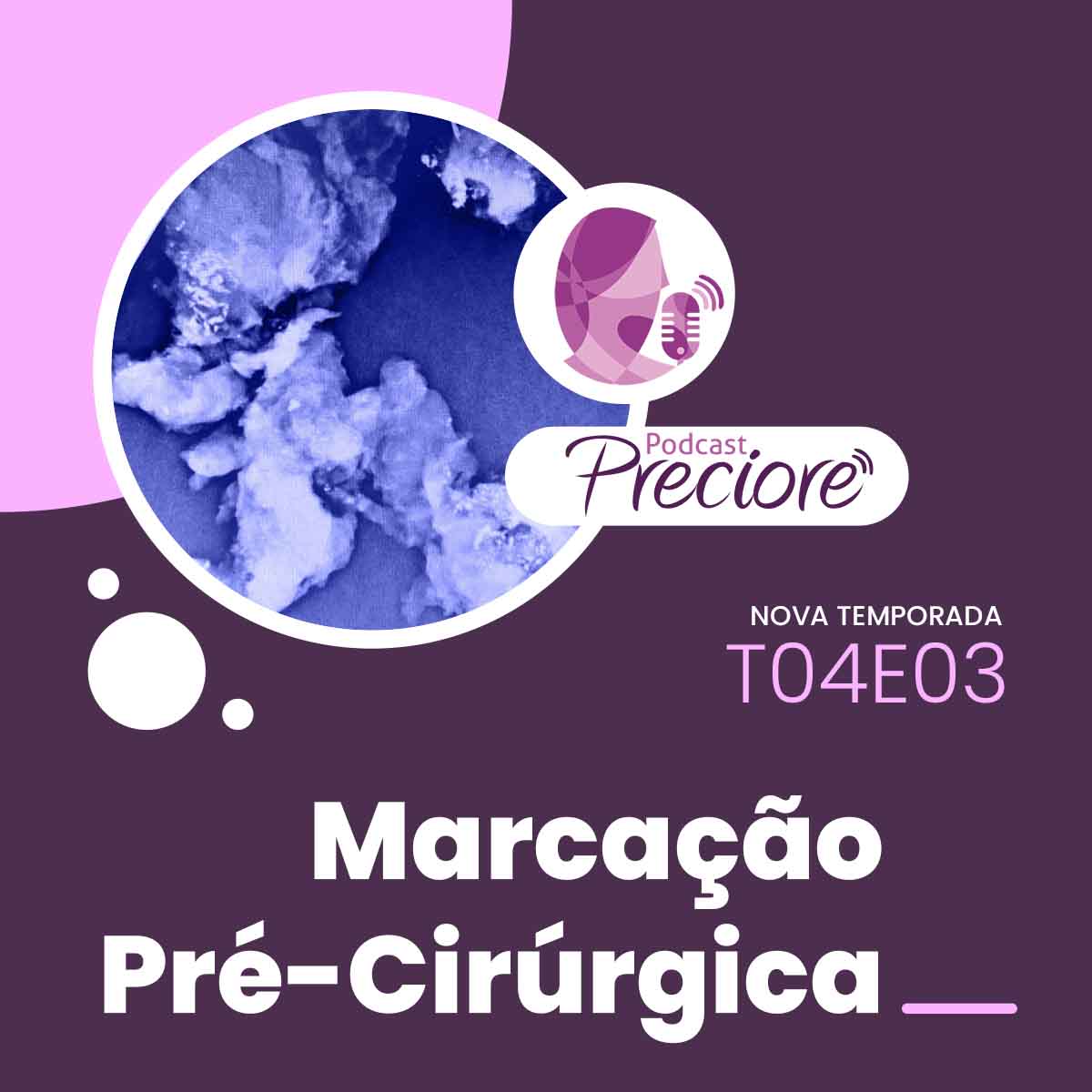 Podcast Preciore - T04E03 - Marcação Pré-Cirúrgica